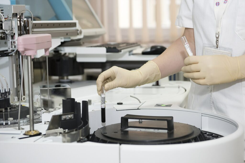 A close-up of a laboratory technician's gloved hand placing a blood sample vial into an automated clinical analyzer for processing in a modern medical laboratory.